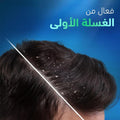 Head & Shoulders Anti-Dandruff Shampoo Itchy Scalp Peppermint 400ml