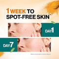 Clean and Clear Face Wash Turmeric Dark Spot Clear Himalaya 100ml