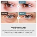 Dr. Melaxin T-X Eye Cream with Tranexamic Acid and Retinal for Dark Circles and Wrinkles, 40g