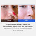 Exfoliating Pads for Face Pore Minimizing BHA AHA Medicube 70 Pads
