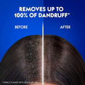 Head & Shoulders Classic Clean Anti-Dandruff Shampoo 350ml