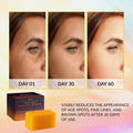 Best Kojic Acid Soap for Dark Spots Skin Lightening Valitec 200g