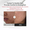Soothing Cream for Irritated Skin Hypochlorous Acid Fast Soothing Medicube 50ml