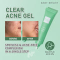 Persa Gel 10 Maximum Strength Acne Clearing Gel Baby Bright 15g