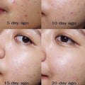 Acne Kit AHA BHA PHA Exfoliating Blemish Control Some By Mi 4-Piece Set