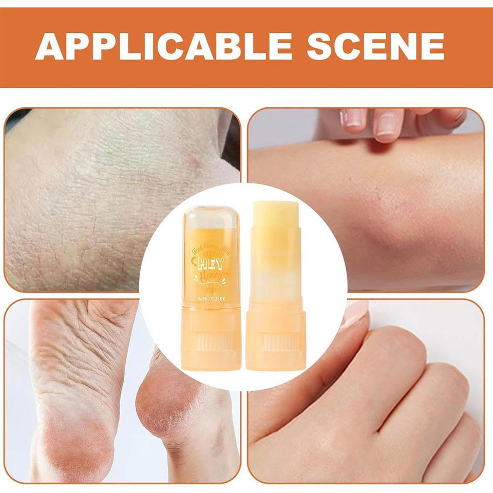 Ushas Honey Foot Care Cream Stick Moisturizing Relief for Dry Feet 6.5 gm