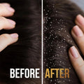 Pantene 2-in-1 Anti-Dandruff Shampoo and Conditioner 375ml