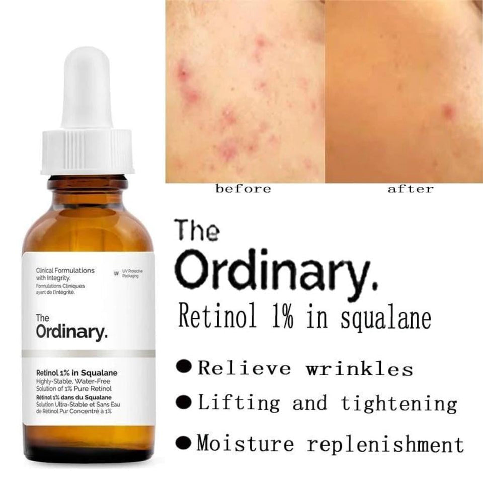 The Ordinary Retinol 1% in Squalane Serum Anti-Aging Skin Renewal 30ml