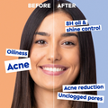 Nivea Deep Cleansing Pore Facial Wash with Salicylic Acid, 150ml