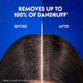 Head & Shoulders Smooth & Silky Anti-Dandruff Shampoo 350ml