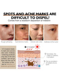 Alpha Arbutin Brightening Face Lotion Dark Spots Freckles Vibrant Glamour 80ml