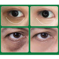 Brightening Under Eye Patches with Hydrating Serum - Aichun Beauty - 5 Pack