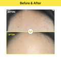 Cream for Pigmentation on Face Alpha-Arbutin Brightening Tiam 50ml