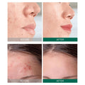 Some By Mi Skincare Starter Set, AHA BHA PHA, 4-Piece Kit