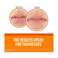 Best Lip Balm for Dry Lips Unscented O'Keeffe's Lip Repair 4.2g