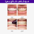 Hismile Whitening Strips V34 Color-Correcting PAP 14 Strips