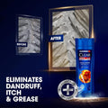Clear Men Anti-Hair Loss Anti-Dandruff Shampoo with Vitamin B3 & Coffee Seed, 600ml