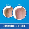 Foot Cream for Dry Feet Deep Moisturizing O'Keeffe's 181g