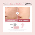 Medicube PDRN Pink Collagen Exosome Shot Serum - 30ml