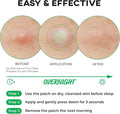 Microneedle Blemish Patches with Cica and Salicylic Acid by Rael, 9 Patches