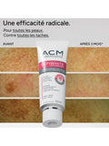 ACM Dépiwhite Advanced Spot Correcting Cream - 40ml