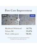 Top Rated Clay Mask Zero Pore Blackhead Clearing Pore Refining Medicube 100g
