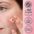 Spot Healing Gel Salicylic Acid Acne Treatment Purederm 20ml