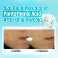 Numbuz:n No. 1 Panthenol B5 Soothing Cream - Vitamin B5, 80ml