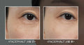 Firming Face Cream with Bio-Spicules for Pore and Texture Care Dr. Melaxin 50ml