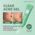 Baby Bright Clear Tea Tree Blemish Care Gel for Acne-Prone Skin, 15g