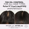 Purifying Scalp Shampoo for Itchy Dry Scalp Hyaluronic Acid L'Oreal 600ml