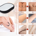 Jellys Hair Removal and Exfoliation Tool, Manual Device, All Skin Types