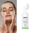 Face Wash for Oily Skin Acne Control Tea Tree & Aloe Vera Novaclear 100ml