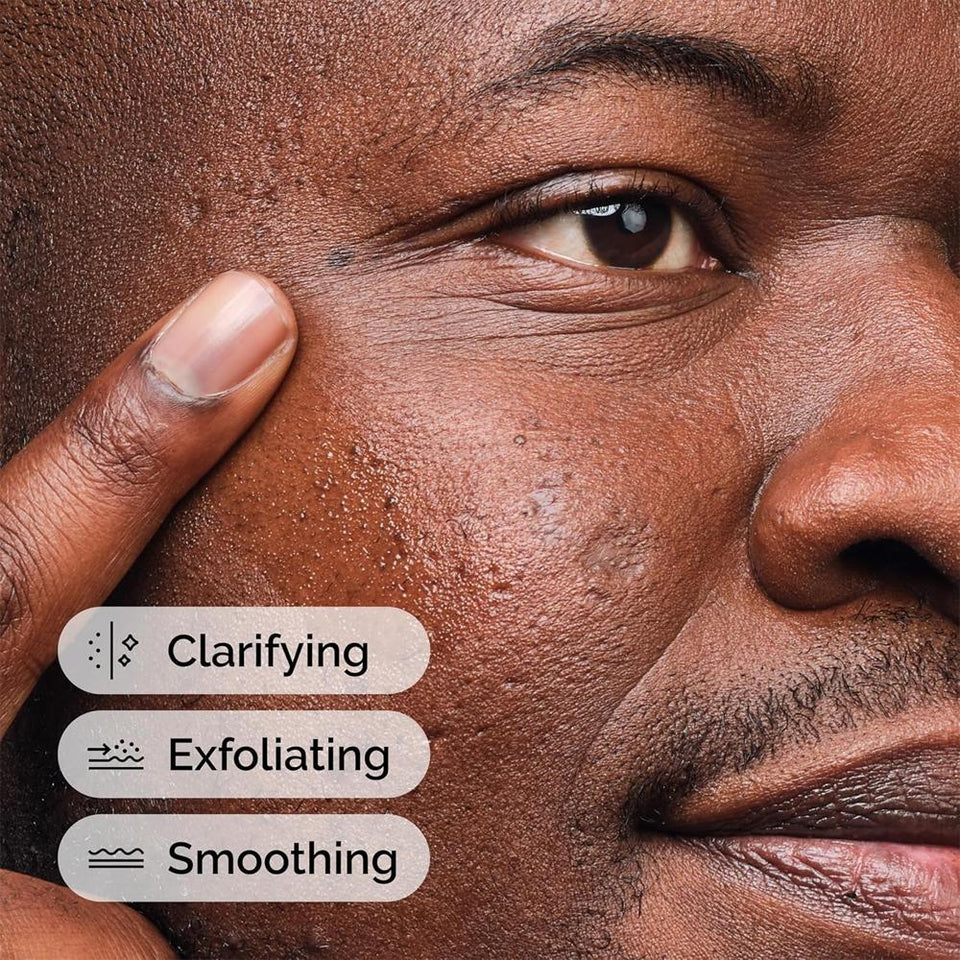 The Ordinary Salicylic Acid 2% Solution Acne Treatment for Clear Skin 30ml