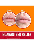 Best Lip Balm for Dry Lips Cherry Oil Vitamin E O'Keeffe's 8.4g