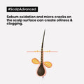 Shampoo for Itchy Scalp Anti-Oiliness AHA Exfoliating L'Oréal Professionnel 300ml