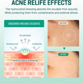 Some By Mi Acne Patches for Blemish Support, 18 Count