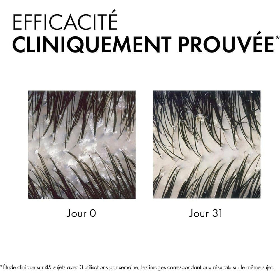 Vichy Dercos Anti-Dandruff Dermatological Shampoo for Dry Hair 390ml