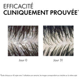 Vichy Dercos Anti-Dandruff Dermatological Shampoo for Dry Hair 390ml