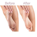 Maxdona Plastic Foot File Exfoliator for Cracked Heels
