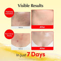 Best Vitamin C Cream for Hyperpigmentation Brightening Equal Berry 50ml