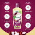 Hair Oil for Hair Fall Red Onion Nourishing Vatika 200ml