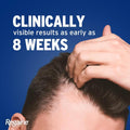 Scalp Revitalising Foam with Minoxidil 5% for Fuller Looking Hair 73ml