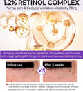 Retinol Serum with Pro-Xylane Ampoules for Skin Smoothing - Vibrant Glamour 15pc