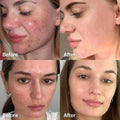 Face Serum for Dry Skin Succinic Acid Clarifying Medicube 30ml