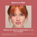 Isdin Photo Ultra SPF 50 Sunscreen for Redness-Prone Skin 50ml