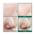 AHA BHA PHA Care Serum Exfoliating Tea Tree Extract Some By Mi 50ml