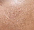 Derma Doctor Picture Pore Minimizing Primer for Oily Skin, 30ml