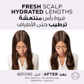 L'Oreal Paris Elvive Hyaluron Pure Shampoo, Salicylic Acid, 400ml