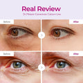 Calcium Firming Under-Eye Patches for Dark Circles Dr. Melaxin 60 Pieces